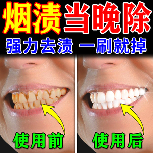 强力去烟渍牙膏去牙渍牙垢黄牙结石克星速效清除神器一擦即除牙膏