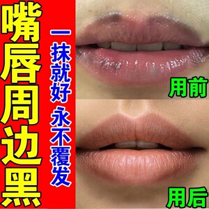 嘴角发黑去除去黑色素暗沉改善唇周黑嘴巴周围黑黑的嘴唇唇膜唇角