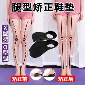 【日本骨グ科専研】O型X型小腿外翻矫正腿型直腿矫正鞋垫男女可用