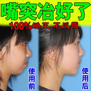 矫正带夜间口呼吸嘴突凸嘴防止儿童张嘴巴睡觉神器珍姐生态果园32