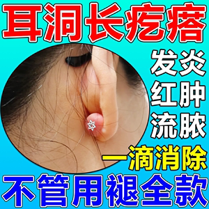 耳洞增生疙瘩护理液耳朵发炎专用药膏清洁消炎去除疤痕增生凸起