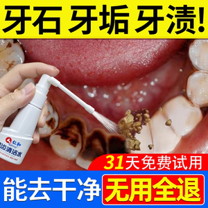 仁和牙结石去除器漱口水溶解牙石非速效洗牙齿污垢牙黄垢口臭神器