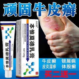 治疗皮肤皮炎湿疹软膏牛皮癣银皮屑药膏成人去慢性顽固外用克星根