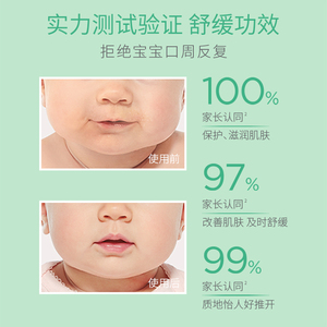 怡思丁儿童唇周膏宝宝口水膏口水疹膏婴儿儿童专用护肤口周滋润