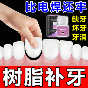 补牙材料永久自己在家补牙洞填充剂牙缝宽大修护树脂补牙材料医用