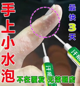 去手上小水泡药膏手指头长水泡脱皮干裂皮肤过敏汗疱泡疹止痒软膏