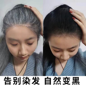 白发治根转黑发精华液少年白头产后神器变黑老年克星何首乌乌发液