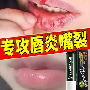 波士顿男士润唇膏防干裂脱皮保湿滋润补水护嘴唇去死皮口油秋冬季