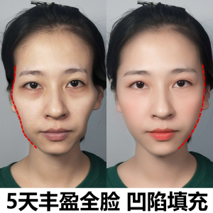 【薇娅推荐】丰盈精油 填充你的美 丰太阳穴额头脸部凹陷填充神器