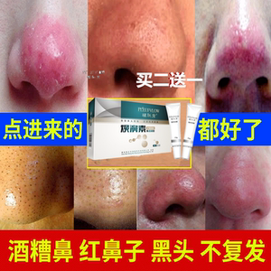 红鼻头鼻螨清