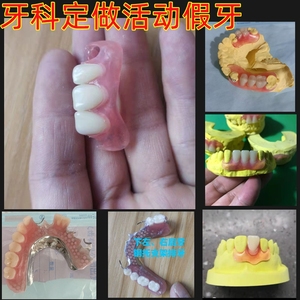 假牙定制