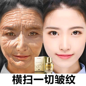 00wugezhuai淘宝正品桑春雪六胜肽紧致补水淡斑美白祛红血丝润护奢