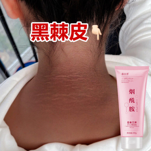 黑脖子不见了~全身磨砂膏去除黑色素沉淀 颈腋下手臂洗不干净棘皮