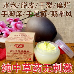 鹅掌风治手气手癣水泡脱皮干裂脚藓止痒特效汗疱疹成人掌灵膏药膏