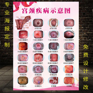 女人妇科图