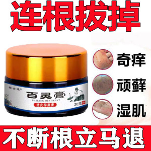 牛皮癣银屑特效顽固性专用药膏手足头癣皮肤过敏止痒大腿外用药膏