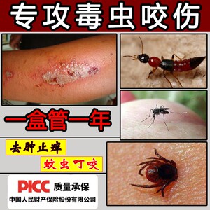 红火蚂蚁咬伤药膏被蚊子叮的咬了隐翅虫治疗跳蚤虫子叮咬止痒消肿