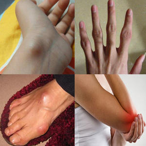 005人付款天猫网球肘专用膏贴肱骨上外髁炎胳膊疼痛手肘关节麻护肘贴