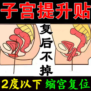 子宫托子宫脱垂