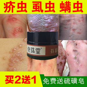 虱疥一扫光硫磺软膏去除阴虱阴囊潮湿疥虫螨虫身上皮肤痒止痒乳膏