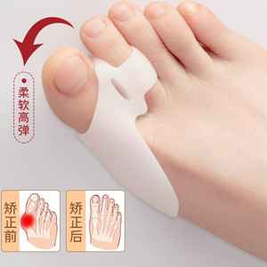 大脚骨拇指外翻硅胶矫正器分趾器防磨防痛【穿在鞋里 效果更好】