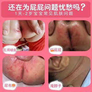 中间品位淘宝赫曼面霜婴儿护肤山茶油膏50g宝宝润肤霜新生儿童滋润