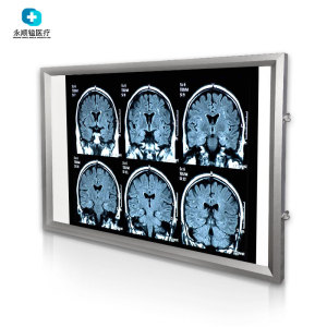 x光观片灯医用led超薄三联牙科骨科阅片灯箱遥控调光单双联看片灯