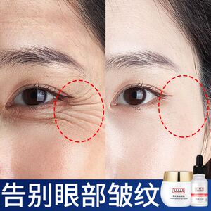 眼霜祛眼袋皱纹