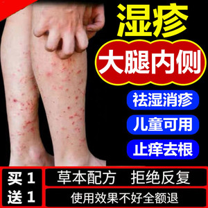 成人儿童湿疹皮肤专用治疗大腿内侧痒抑菌百草止痒药膏去根无激素