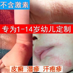 治疗白色糠疹皮炎婴儿湿疹专用药膏止痒抑菌皮肤儿童专用药无激素