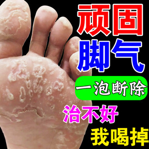泡脚药包治脚气臭脚大人儿童治疗去脚癣根除臭止痒出汗感染专用药