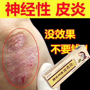 神经性皮炎去根除外用膏进口无激素瘙痒止痒湿疹癣中药脱皮肤过敏