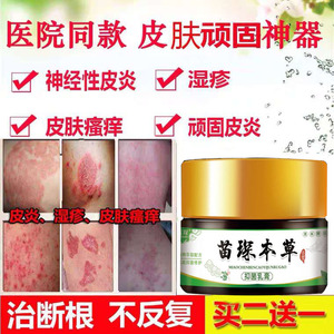 苗医丹毒皮康王药膏正品止痒湿疹皮炎膏灰黄霉素药复方咪康唑软膏