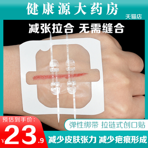 医用皮肤减张器缝合器疤痕减张贴伤口愈合免缝合针拉链式创口贴xp