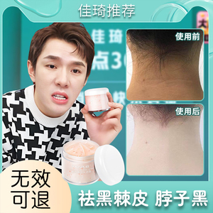 脖子黑黑的黑棘皮症去除去黑色素沉淀药膏治疗后颈洗不干净病神器