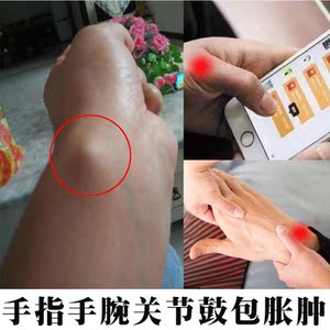 腱鞘囊肿膏 手腕剑健鞘手指疼舒筋贴炎痛舒贴指关节麻木腱鞘鼓包