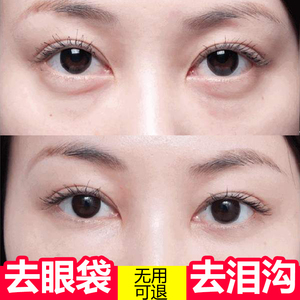 何970379293淘宝去眼袋消浮肿神器眼带霜男女通用眼