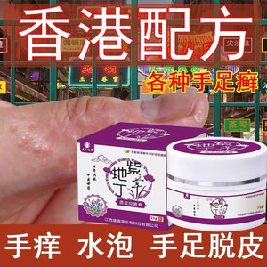 汗状疱疹专用软膏手上起小水泡手痒脱皮干裂止痒汗疱疹鹅掌风药膏