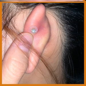 900人付款天猫小飞碟防增生耳骨耳洞疤痕消除垫片硅胶软脐钉耳钉唇钉