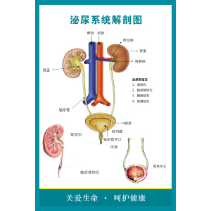 501人付款淘宝泌尿系统尿道结石示意图医学宣传挂图人体器官解剖图