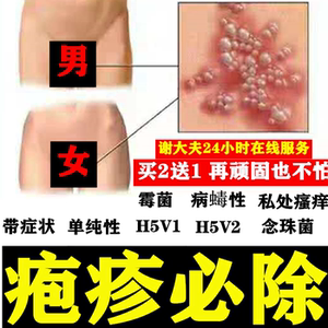男女生殖器疱疹病毒膏私处断根hsv2型疱疹防复发日本带状疱疹药
