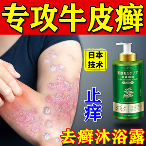 牛皮癣沐浴露治疗顽固牛皮银屑病外用药膏体癣皮肤过敏干燥瘙痒