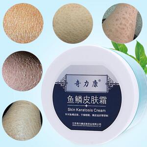 鱼鳞皮肤霜奇力康