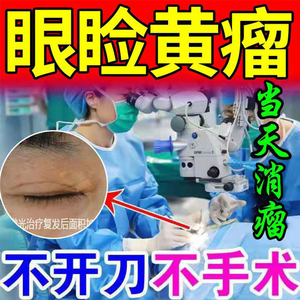 去睑黄瘤膏去除睑黄疣脂肪粒眼部祛黄斑睑黄疣圆康膏面部黄瘤膏
