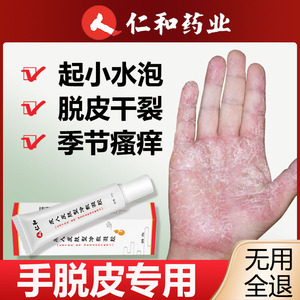 手脱皮手足藓真菌感染脚手上干裂水泡蜕皮专用手痒手气鹅掌风药膏