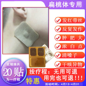 咽扁贴 儿童扁桃体反复发炎咳嗽 扁桃体肿大 肥大扁桃体贴5盒装