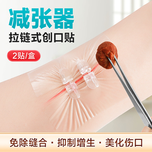 可孚减张贴疤痕免缝合缝针伤口拉链式创口贴创可贴医用皮肤减张器