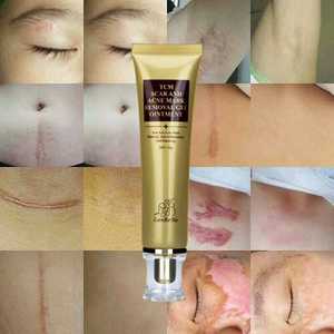 LANBENA 蓝蓓娜TCM SCAR AND ACNE MARK REMOVAL GEL 修复膏