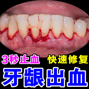 牙龈出血专用牙膏药改善治疗牙龈萎缩修复再生出血肿痛消炎漱口水