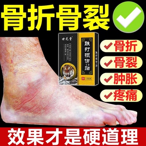 接骨续筋膏骨折骨裂恢复药肌肉韧带拉伤撕裂手腕扭伤脚踝扭伤膏贴